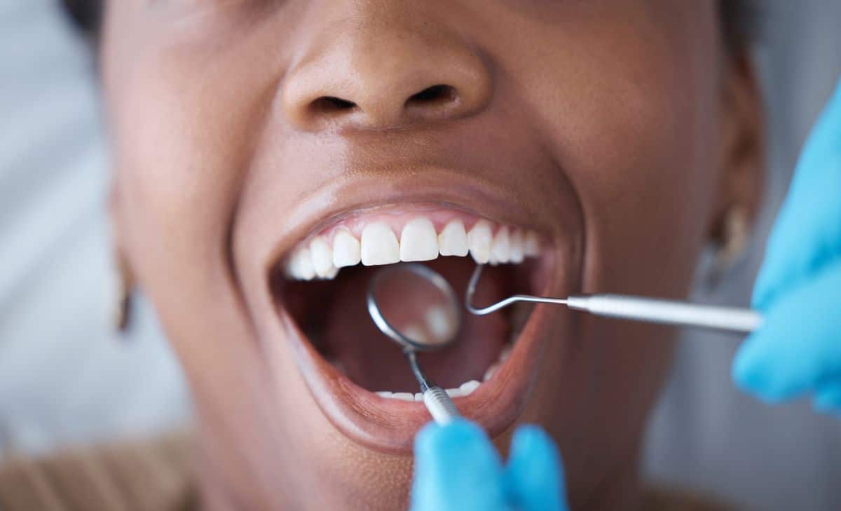 Karies trotz guter Zahnpflege: Wie kann das sein? 2